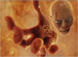 pvt-ring.jpg